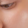 Scandy Spot the F Off Invisible Blemish Patches - Finnilaastari 24 kpl